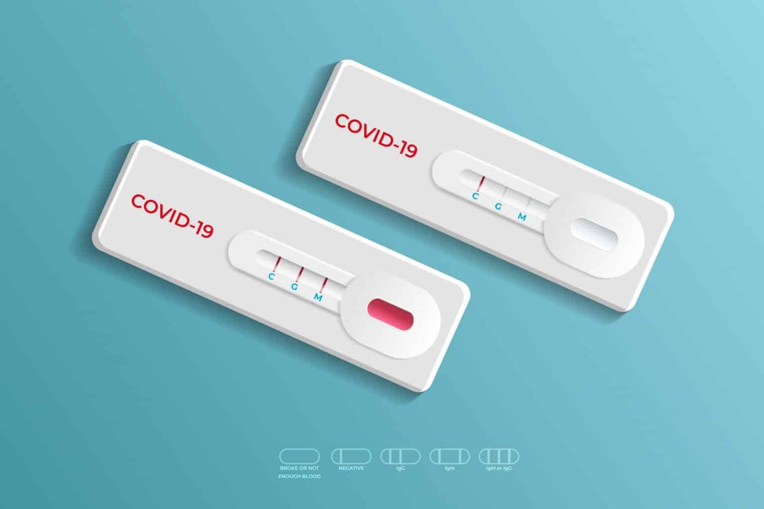 exames de coronavírus pelo plano de saúde